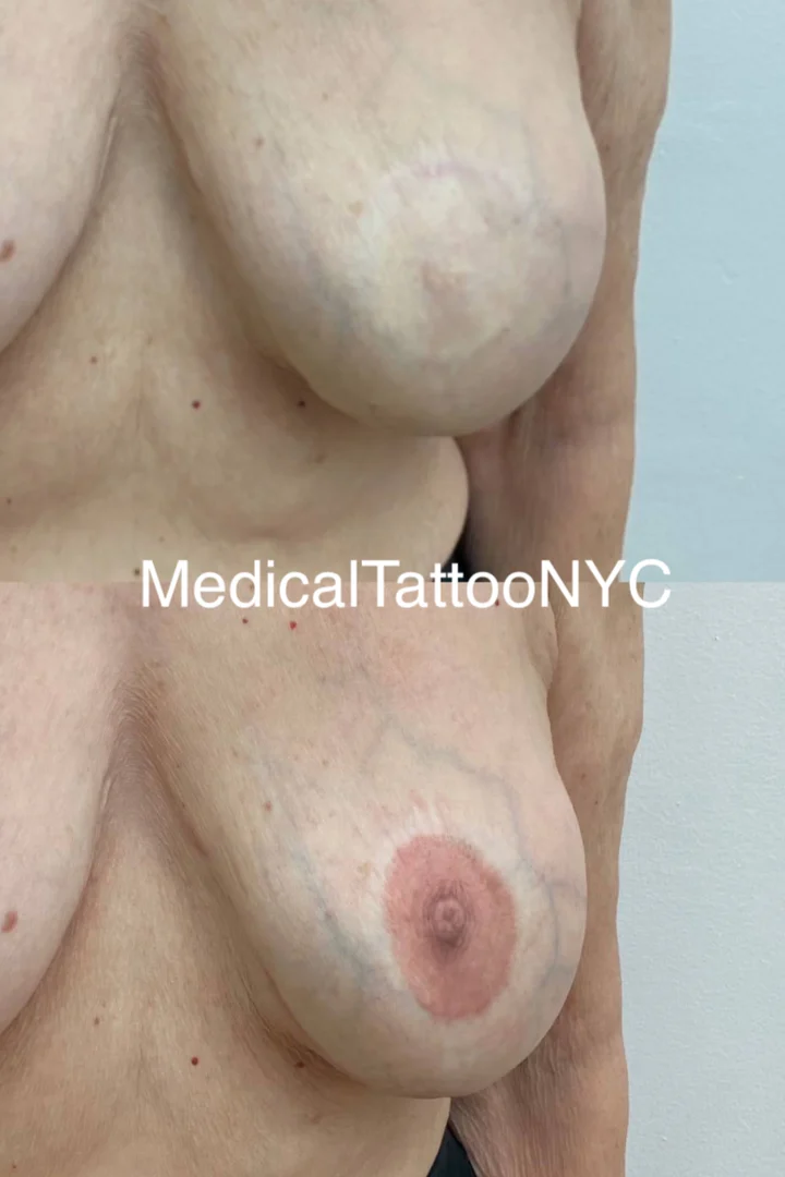 Nipple and areola tattoo result